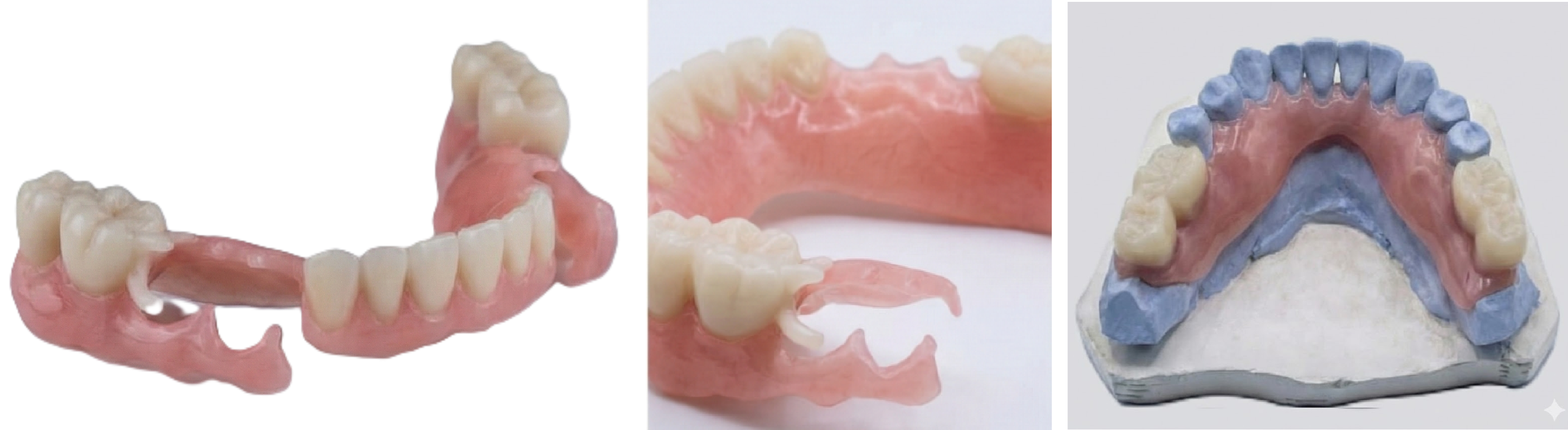 Bioprótesis 3DntLab